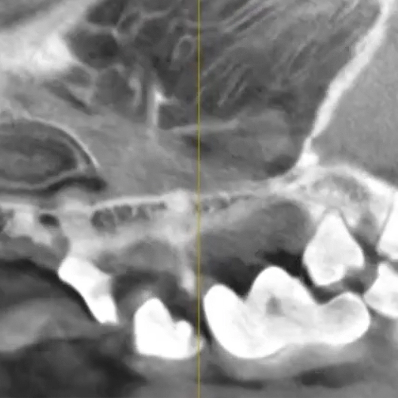 치과 방사선 장비
