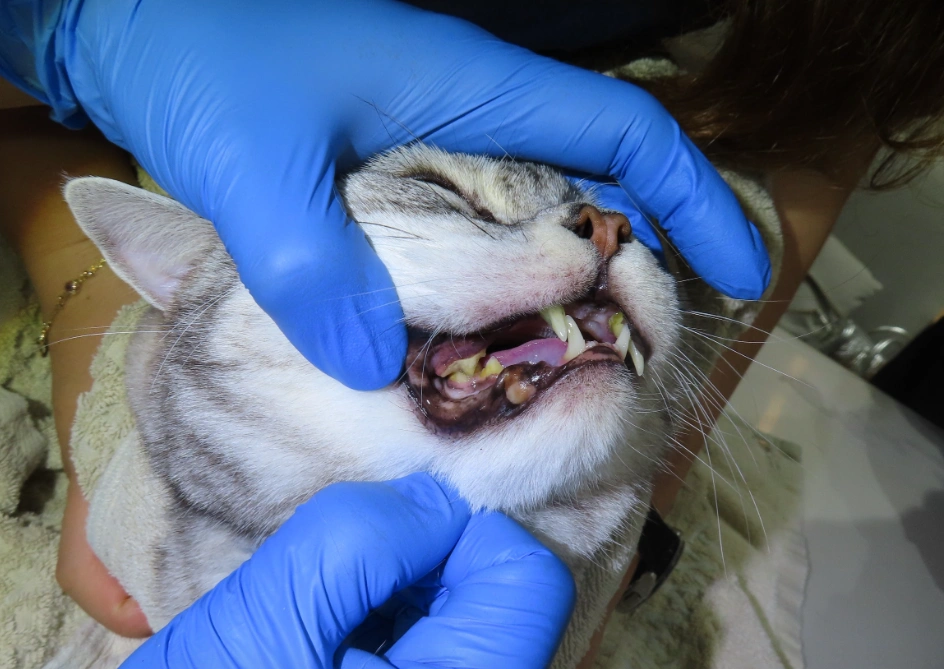 발치가 필요할 수 있는 상황