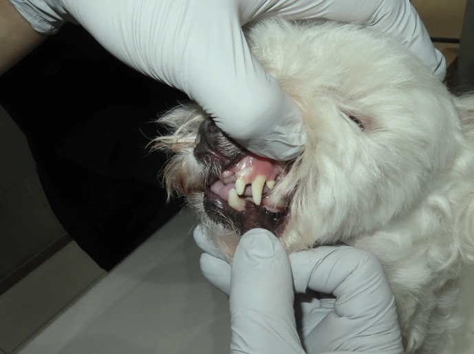 치주 수술 후 통증 및 감염관리 안내