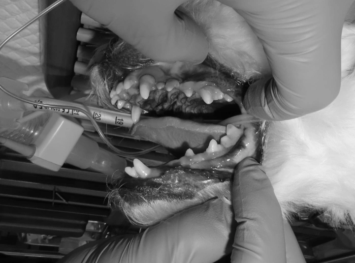 치주질환의 심각성 안내