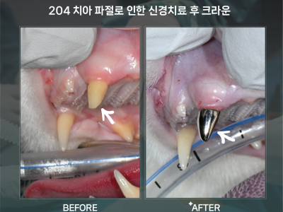 고양이 송곳니 파절, 발치 대신 신경치료와 크라운으로 치아를 보존한 치료 사례